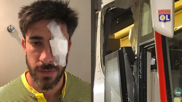 El volante central se retiró del Monumental con un parche en el ojo y ahora pasa algo similar en Francia.