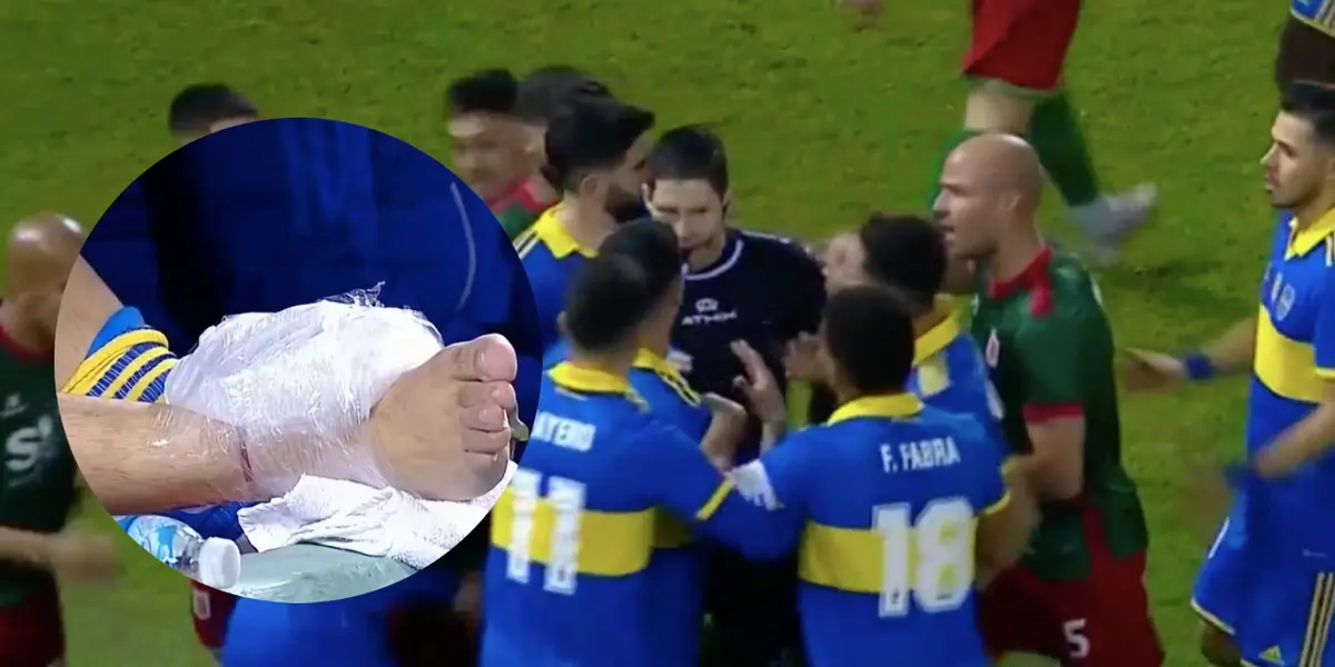 El Changuito recibió una patada criminal y tuvo que dejar la cancha.