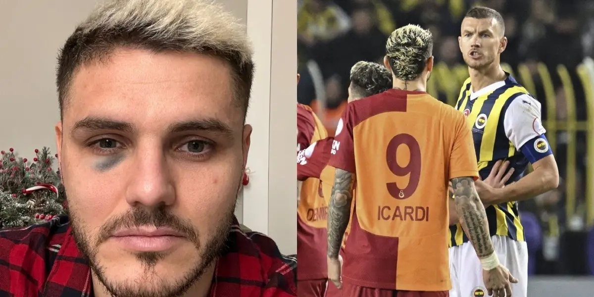 Mauro fue titular en el clásico ante Fenerbahce y finalizó con el rostro lastimado.