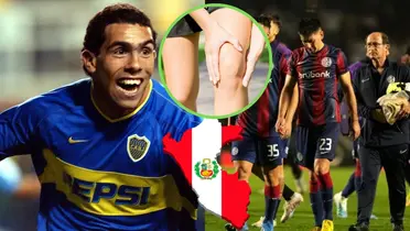 Tevez, equipo de San Lorenzo, bandera de Perú y rodilla lesionada.